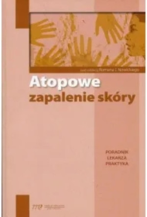 Atopowe zapalenie skóry. Poradnik lekarza praktyka