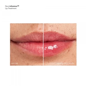 Dr Dennis Gross Derminfusions Plump + Repair Lip Treatment 10 Ml