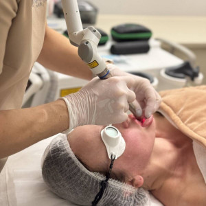 Kompleksowa przebudowa skóry - Fotona 4D | Kraków | Femmalium Clinic | Prezent | Voucher | Karta podarunkowa | Bon | Cena