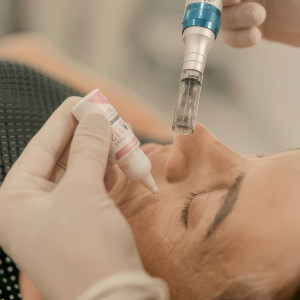 Zabieg na twarz | Szczecin | Skinmed | Mezoterapia igłowa | Prezent | Voucher | Karta podarunkowa | Bon | Cena