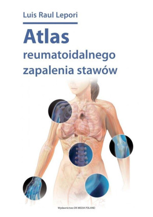 Atlas reumatoidalnego zapalenia stawów / DK Media