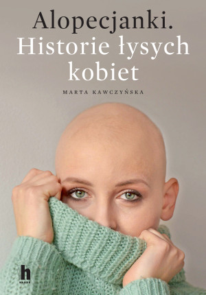 Alopecjanki Historie łysych kobiet