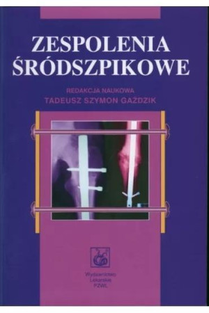 Zespolenia śródszpikowe