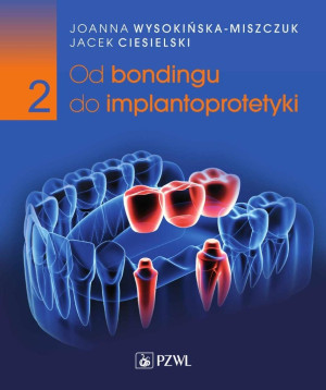 Od bondingu do implantoprotetyki cz.2