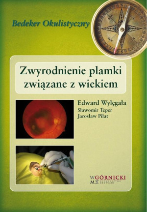 Zwyrodnienie plamki związane z wiekiem