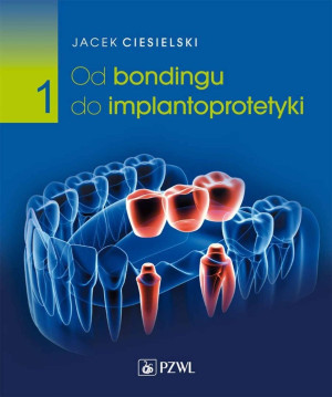 Od bondingu do implantoprotetyki cz. I
