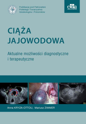 Ciąża jajowodowa. Aktualne możliwości diagnostyczne i terapeutyczne