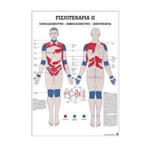 Plansza anatomiczna - FIZJOTERAPIA II Krioterapia