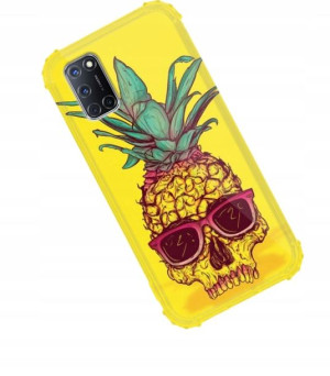 Etui Anti-Shock do OPPO A92 Obudowa Case Wzory