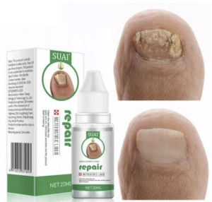 Preparat Na Grzybicę Paznokci Leczenie Stóp 20ml