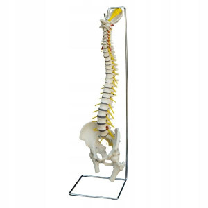 Model anatomiczny KRĘGOSŁUPA Z PRZEPUKLINĄ DYSKU