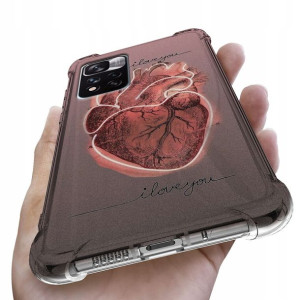 Etui Antishock do XIAOMI REDMI NOTE 11 PRO PLUS 5G