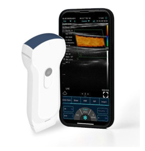 Dwu-głowicowy Aparat USG 3w1 + kolor doppler WIFI USB
