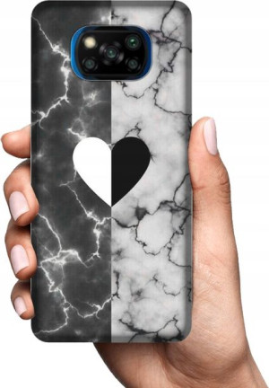 Obudowa Etui Na Xiaomi Poco X3 Wzory Case+szkło