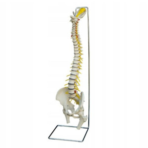 Model Anatomiczny Kręgosłupa Z Przepukliną Dysku