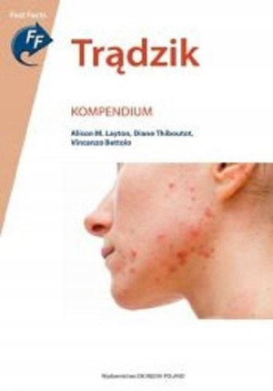 Trądzik. Kompendium