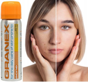 Pianka Granex na trądzik przebarwienia 50ml