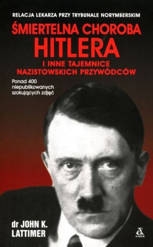 Śmiertelna Choroba Hitlera I Inne Tajemnice Nazist