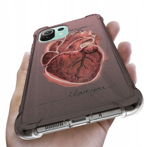 Etui Antishock do XIAOMI MI 11 LITE 5G Modne Wzory