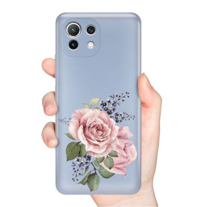 Etui Metalic BLUE do XIAOMI MI 11 LITE 5G Wzory