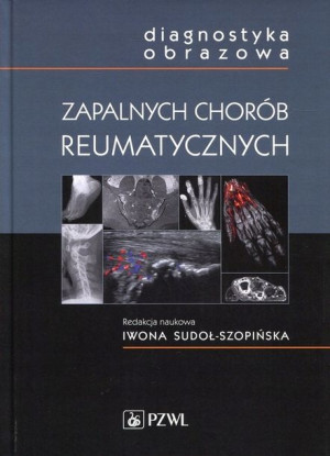 Diagnostyka obrazowa zapalnych chorób reumatyczny