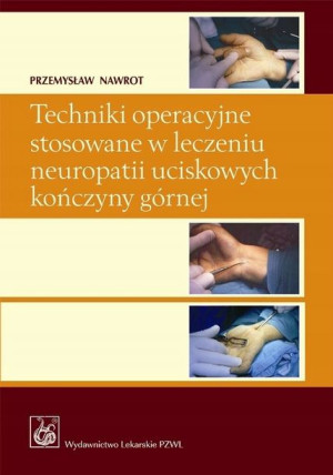 Techniki operacyjne stosowane w leczeniu neurop.