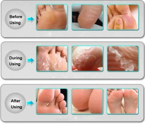 Złuszczające skarpetki peeling