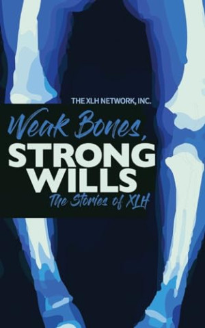 Inc. The XLH Network Weak Bones, Strong Wills: The Stories Of Xlh