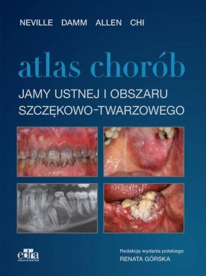 Atlas chorób jamy ustnej i obszaru szczękowo-twarzowego