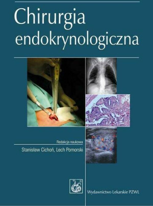 Chirurgia endokrynologiczna