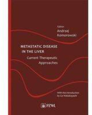 Metastatic Disease in the Liver - Current Therapeutic Approaches