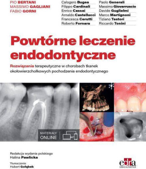 Powtórne leczenie endodontyczne