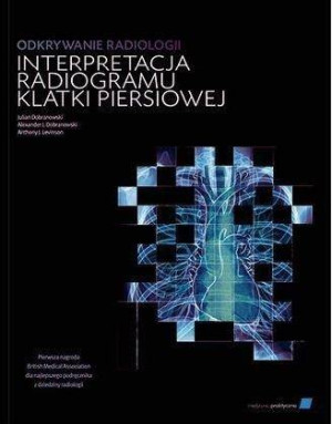 Odkrywanie radiologii interpretacja radiogramu klatki piersiowej