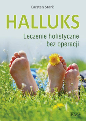 Halluks: Leczenie holistyczne bez operacji
