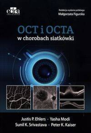 OCT i OCTA w chorobach siatkówki