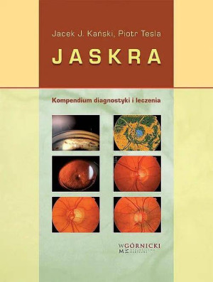 Jaskra. Kompendium diagnostyki i leczenia
