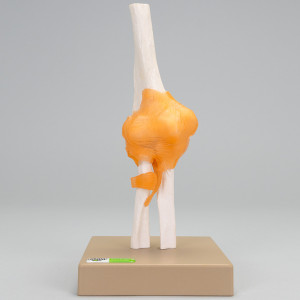 Model stawu, ruchomy – łokciowy