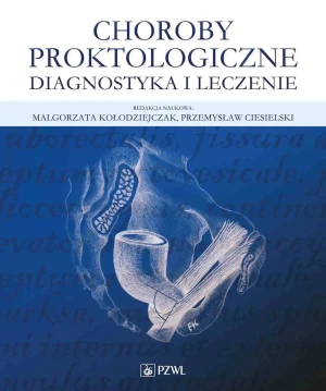 Choroby proktologiczne. Diagnostyka i leczenie - Małgorzata Kołodziejczak - książka