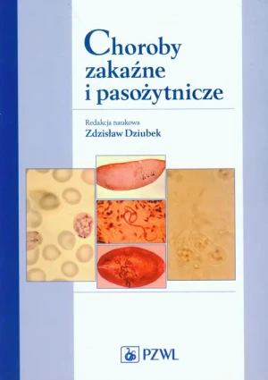 Choroby zakaźne i pasożytnicze - Zdzisław Dziubek (red. nauk.) - książka