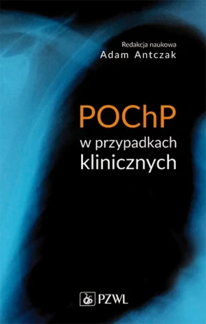 POChP w przypadkach klinicznych - Adam Antczak - książka