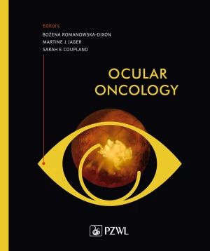 Ocular oncology - Bożena Romanowska-Dixon - książka