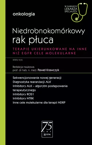 Niedrobnokomórkowy rak płuca - Kulma Dariusz - książka