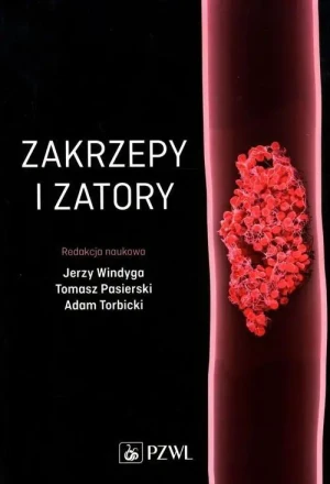 Zakrzepy i zatory - Opracowanie zbiorowe - książka