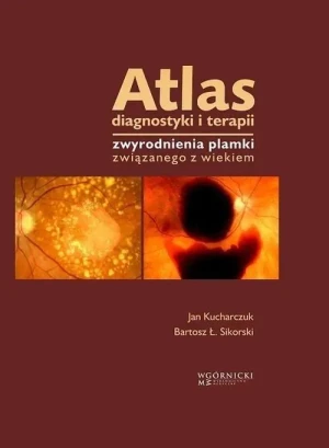 Atlas diagnostyki i terapii zwyrodnienia plamki związanego z wiekiem - Jan Kucharczuk - książka