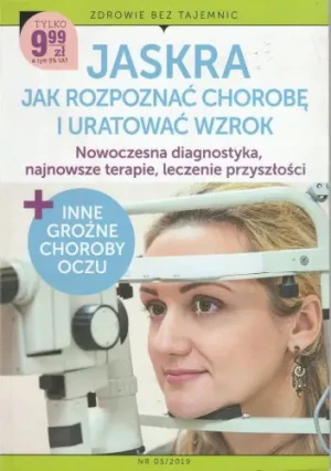 Jaskra jak rozpoznać chorobę i uratować wzrok - Praca zbiorowa - książka