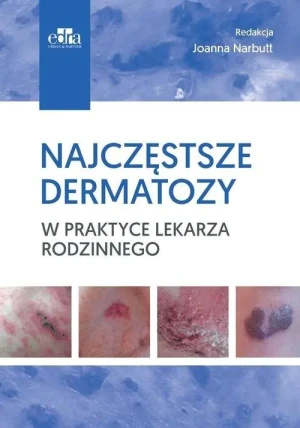 Najczęstsze dermatozy w praktyce lekarza rodzinnego - praca zbiorowa - książka
