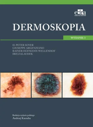Dermoskopia - H.P. Soyer, G. Argenziano, R. Hofmann-Wellenhof, - książka