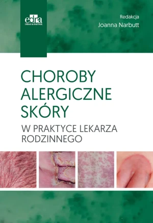 Choroby alergiczne skóry w praktyce lekarza rodzinnego -  - książka