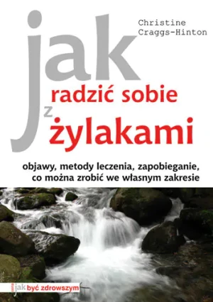 Jak radzić sobie z żylakami - Craggs-Hinton Christine - książka