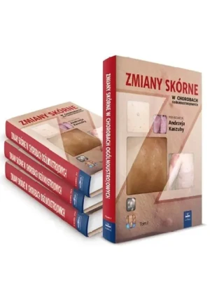 Zmiany skórne w chorobach ogólnoustrojowych Tom 2 - Kaszuba Andrzej - książka